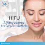 HIFU- lifting bez skalpela